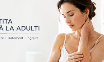 Ce este Dermatita Atopică și Cum se Tratează la Adulți
