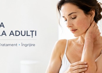 Ce este Dermatita Atopică și Cum se Tratează la Adulți