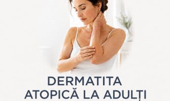 Ce este Dermatita Atopică și Cum se Tratează la Adulți