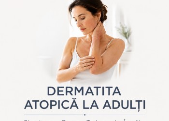 Ce este Dermatita Atopică și Cum se Tratează la Adulți